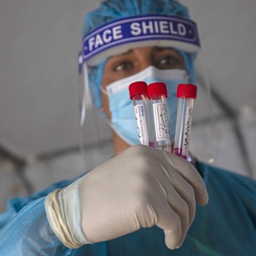 A Palestinian health worker holds swab samples collected to test for Covid-19 in Rafah in the southern Gaza Strip, on February 16, 2021. AFP